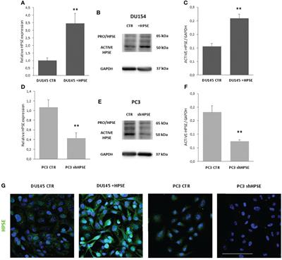 Heparanase regulates EMT and cancer stem cell properties in prostate tumors